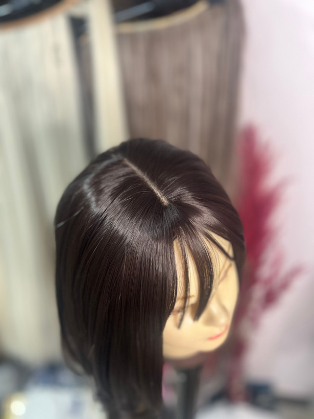 پروتز کفسری پوستی چتری پرده ای