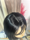 پروتز کفسری پوستی چتری پرده ای