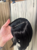 پروتز کفسری پوستی چتری پرده ای